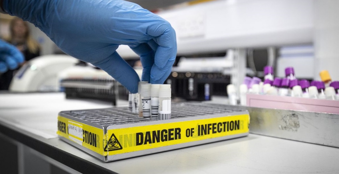 Dhjetera te infektuar, Kina po monitoron nje virus te ri